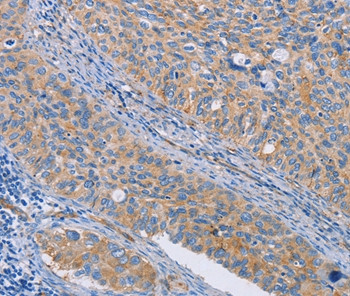 Calpain 7 Antibody in Immunohistochemistry (Paraffin) (IHC (P))