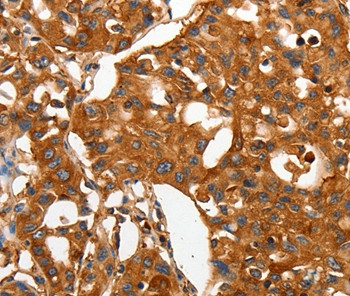 CAP2 Antibody in Immunohistochemistry (Paraffin) (IHC (P))