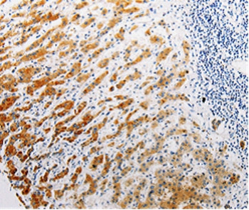 CLEC1B Antibody in Immunohistochemistry (Paraffin) (IHC (P))