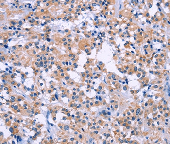 DUSP22 Antibody in Immunohistochemistry (Paraffin) (IHC (P))