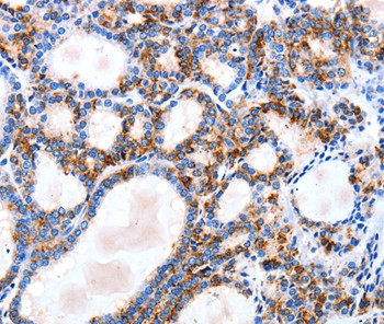 IGSF6 Antibody in Immunohistochemistry (Paraffin) (IHC (P))