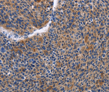 IGSF10 Antibody in Immunohistochemistry (Paraffin) (IHC (P))