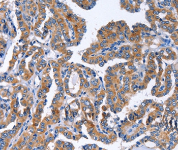 IGSF10 Antibody in Immunohistochemistry (Paraffin) (IHC (P))