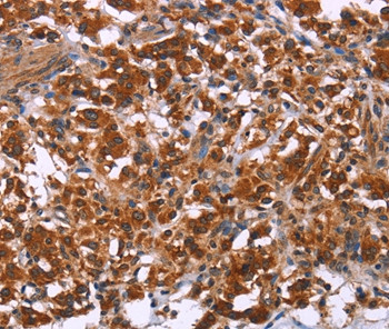 ING2 Antibody in Immunohistochemistry (Paraffin) (IHC (P))