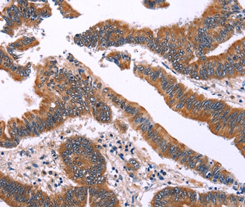 IRAK1BP1 Antibody in Immunohistochemistry (Paraffin) (IHC (P))