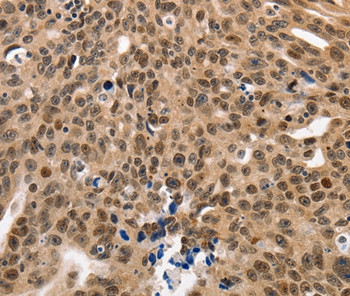 NAIF1 Antibody in Immunohistochemistry (Paraffin) (IHC (P))