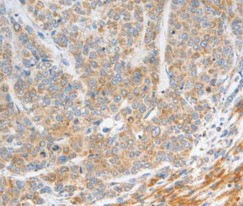 NTS Antibody in Immunohistochemistry (Paraffin) (IHC (P))