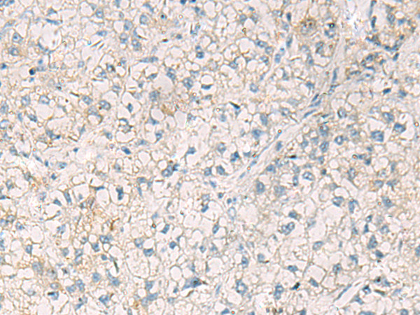 OAS2 Antibody in Immunohistochemistry (Paraffin) (IHC (P))