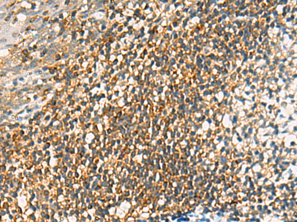 OAS2 Antibody in Immunohistochemistry (Paraffin) (IHC (P))