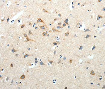 SCG3 Antibody in Immunohistochemistry (Paraffin) (IHC (P))