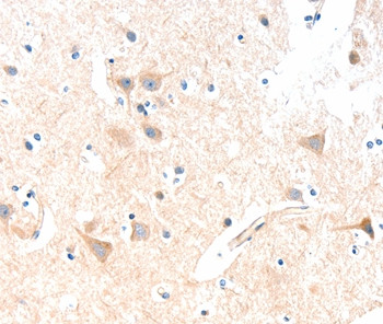 SLC19A2 Antibody in Immunohistochemistry (Paraffin) (IHC (P))