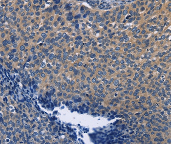 SYT17 Antibody in Immunohistochemistry (Paraffin) (IHC (P))