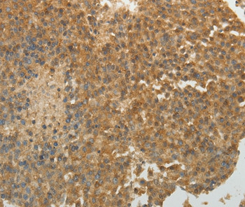 SULT1E1 Antibody in Immunohistochemistry (Paraffin) (IHC (P))