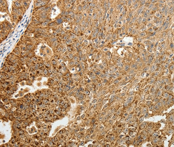 TFF2 Antibody in Immunohistochemistry (Paraffin) (IHC (P))