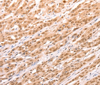 TAX1BP1 Antibody in Immunohistochemistry (Paraffin) (IHC (P))