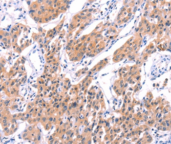 Unc18-2 Antibody in Immunohistochemistry (Paraffin) (IHC (P))