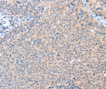 AADACL2 Antibody in Immunohistochemistry (Paraffin) (IHC (P))