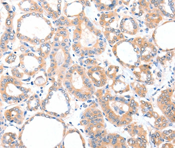 AADACL2 Antibody in Immunohistochemistry (Paraffin) (IHC (P))