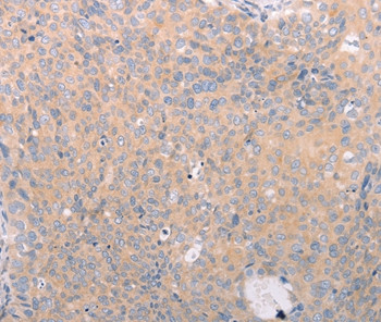 ABCF3 Antibody in Immunohistochemistry (Paraffin) (IHC (P))