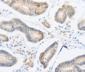 ABHD1 Antibody in Immunohistochemistry (Paraffin) (IHC (P))