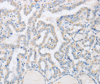 ABHD1 Antibody in Immunohistochemistry (Paraffin) (IHC (P))