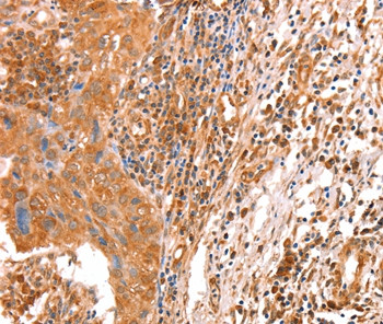 ACAD9 Antibody in Immunohistochemistry (Paraffin) (IHC (P))