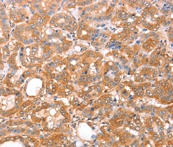 ACAD9 Antibody in Immunohistochemistry (Paraffin) (IHC (P))