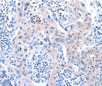 ACAD11 Antibody in Immunohistochemistry (Paraffin) (IHC (P))