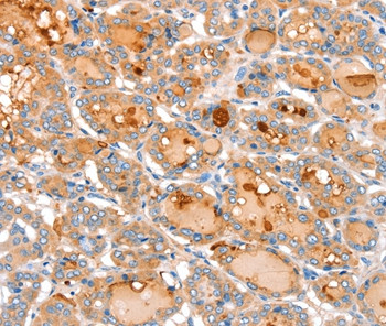 ACOX2 Antibody in Immunohistochemistry (Paraffin) (IHC (P))