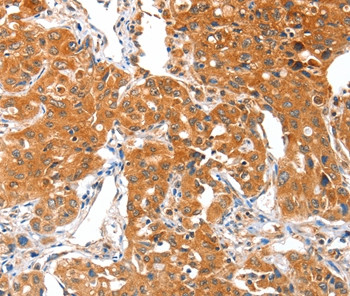 ACSBG1 Antibody in Immunohistochemistry (Paraffin) (IHC (P))