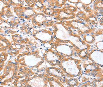 ACSBG1 Antibody in Immunohistochemistry (Paraffin) (IHC (P))