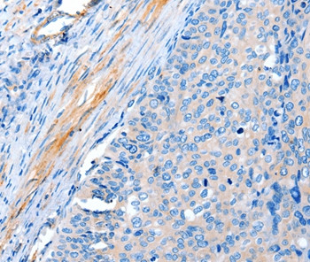 ACTRT1 Antibody in Immunohistochemistry (Paraffin) (IHC (P))