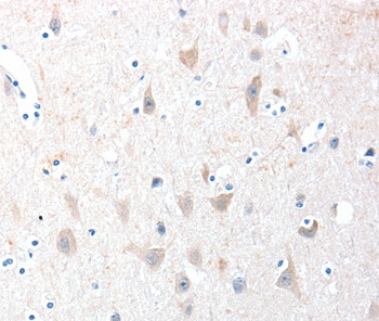 ADAM20 Antibody in Immunohistochemistry (Paraffin) (IHC (P))