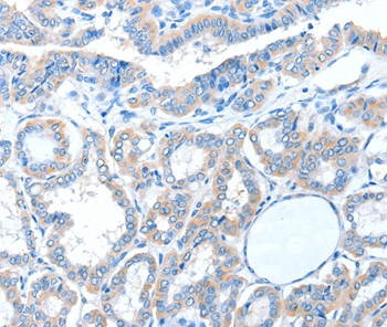 ADAM21 Antibody in Immunohistochemistry (Paraffin) (IHC (P))