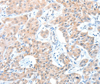 ADAM21 Antibody in Immunohistochemistry (Paraffin) (IHC (P))