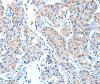 ADAMTSL1 Antibody in Immunohistochemistry (Paraffin) (IHC (P))