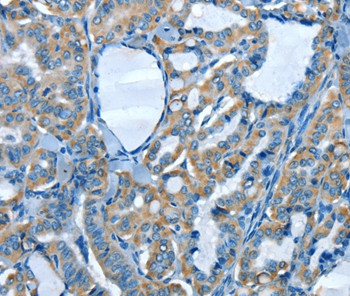 ADCK4 Antibody in Immunohistochemistry (Paraffin) (IHC (P))