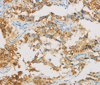 IDH3B Antibody in Immunohistochemistry (Paraffin) (IHC (P))