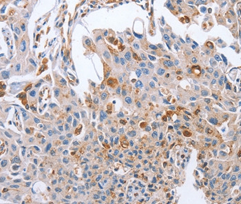 NRG4 Antibody in Immunohistochemistry (Paraffin) (IHC (P))