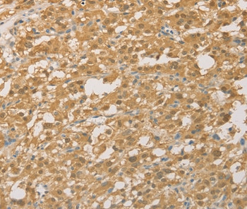 PGK2 Antibody in Immunohistochemistry (Paraffin) (IHC (P))