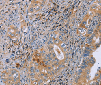 GMFG Antibody in Immunohistochemistry (Paraffin) (IHC (P))