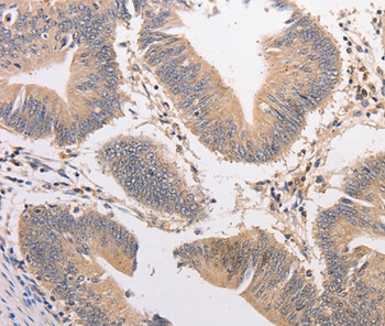 PIP5K1A Antibody in Immunohistochemistry (Paraffin) (IHC (P))