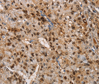 TSPEAR Antibody in Immunohistochemistry (Paraffin) (IHC (P))