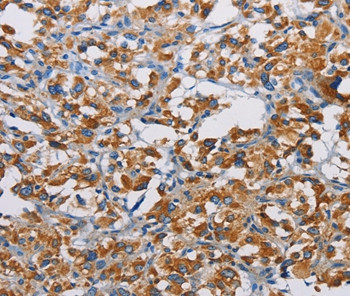 TSPEAR Antibody in Immunohistochemistry (Paraffin) (IHC (P))