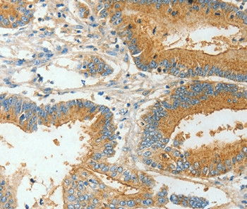 BAAT Antibody in Immunohistochemistry (Paraffin) (IHC (P))