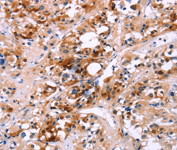 Calbindin D28K Antibody in Immunohistochemistry (Paraffin) (IHC (P))