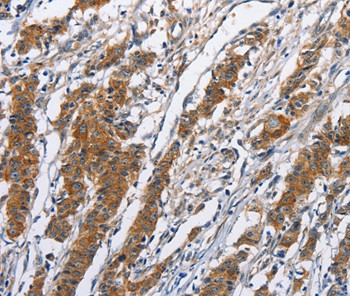 NCAPD3 Antibody in Immunohistochemistry (Paraffin) (IHC (P))