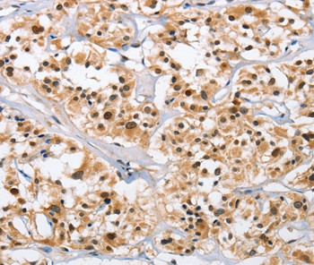 NCAPD3 Antibody in Immunohistochemistry (Paraffin) (IHC (P))