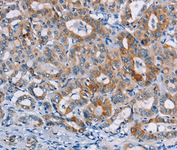 CASC3 Antibody in Immunohistochemistry (Paraffin) (IHC (P))