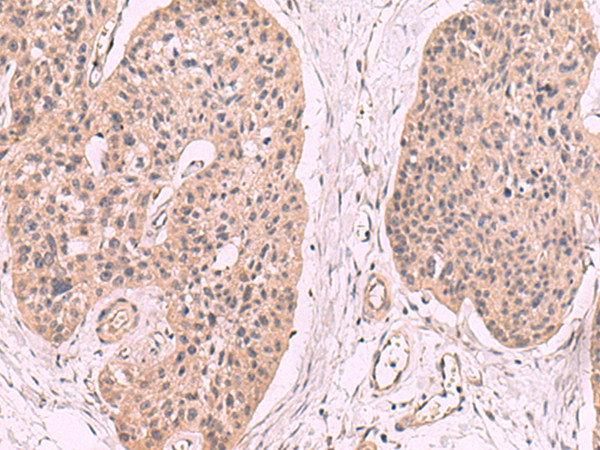 KLRB1 Antibody in Immunohistochemistry (Paraffin) (IHC (P))